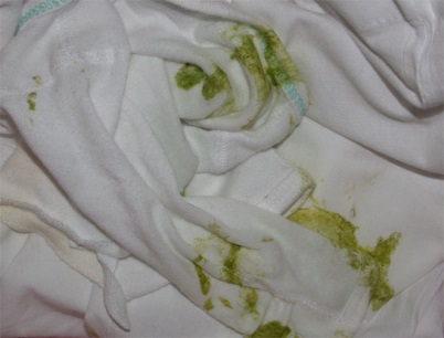 Figure 1: Bile vomitus