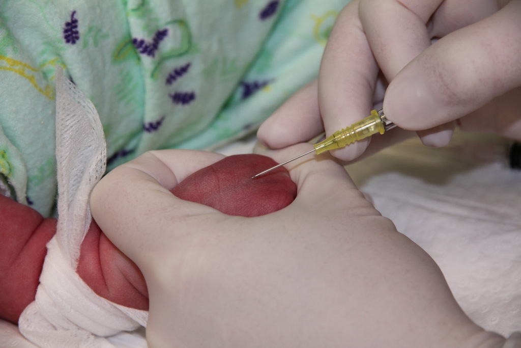 Figure 3: Stabilising the vein