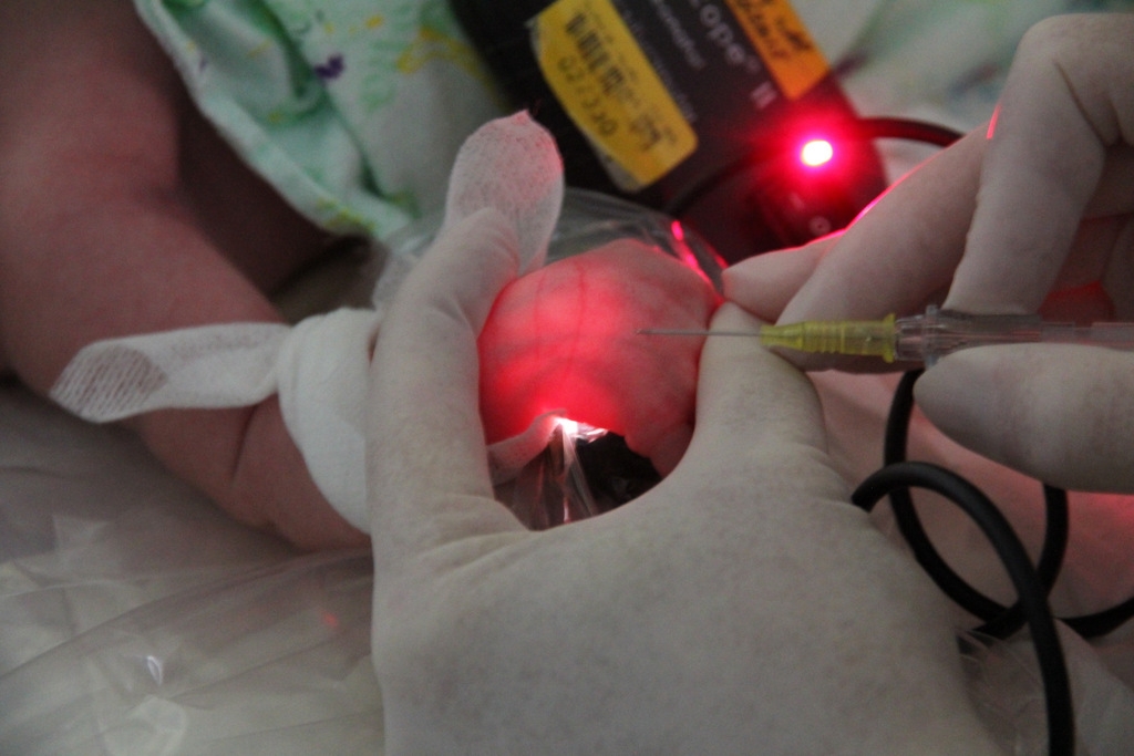 Figure 2: Visualising the vein, IV insertion