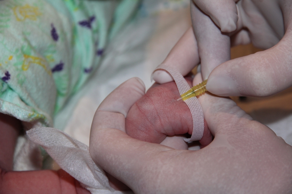 Figure 4: Securing the IV cannula 1
