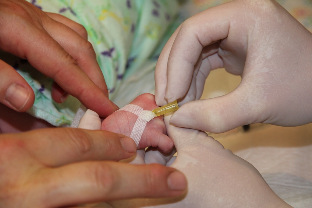 Figure 6: Securing the IV cannula 3