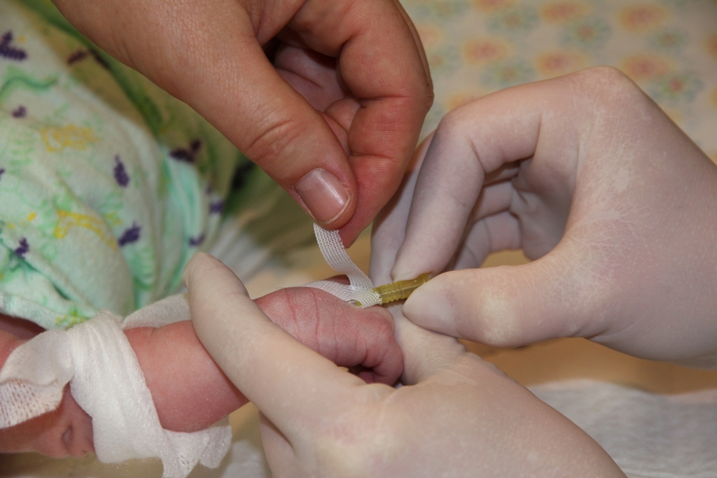 Figure 5: Securing the IV cannula 2
