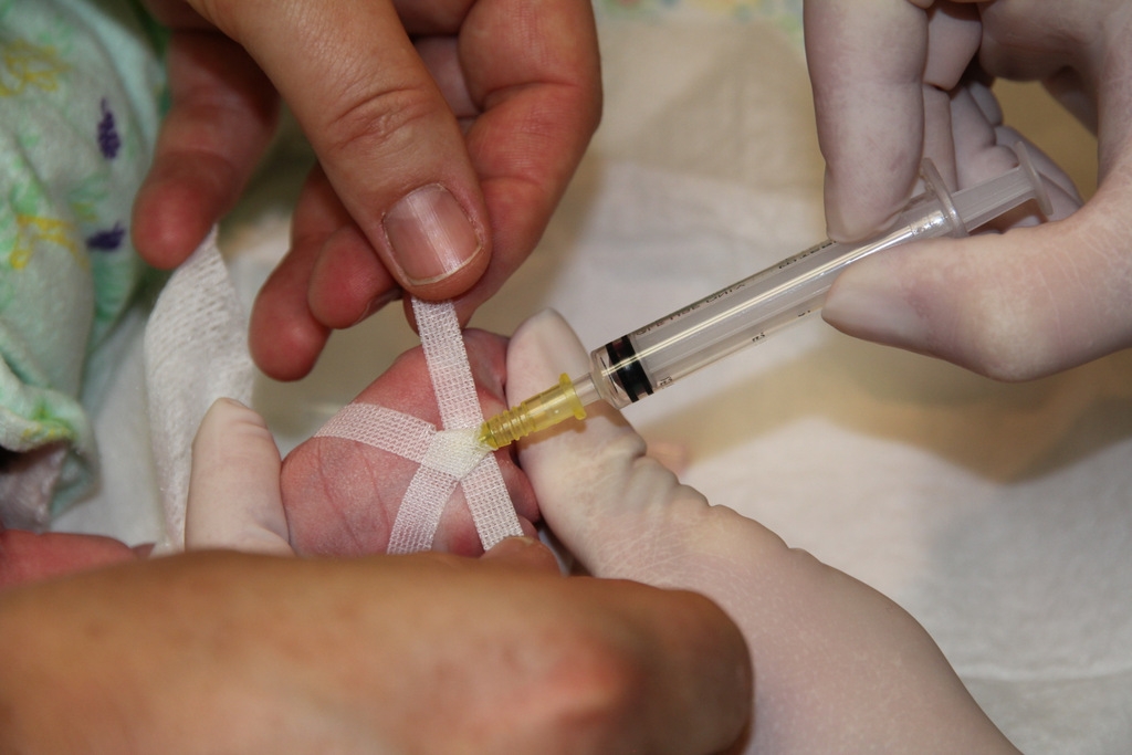 Figure 7: Securing the IV cannula 4