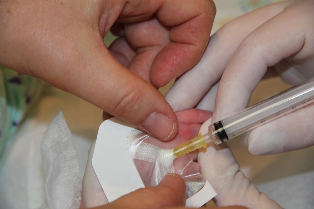 Figure 9: Placing tegaderm over IV site
