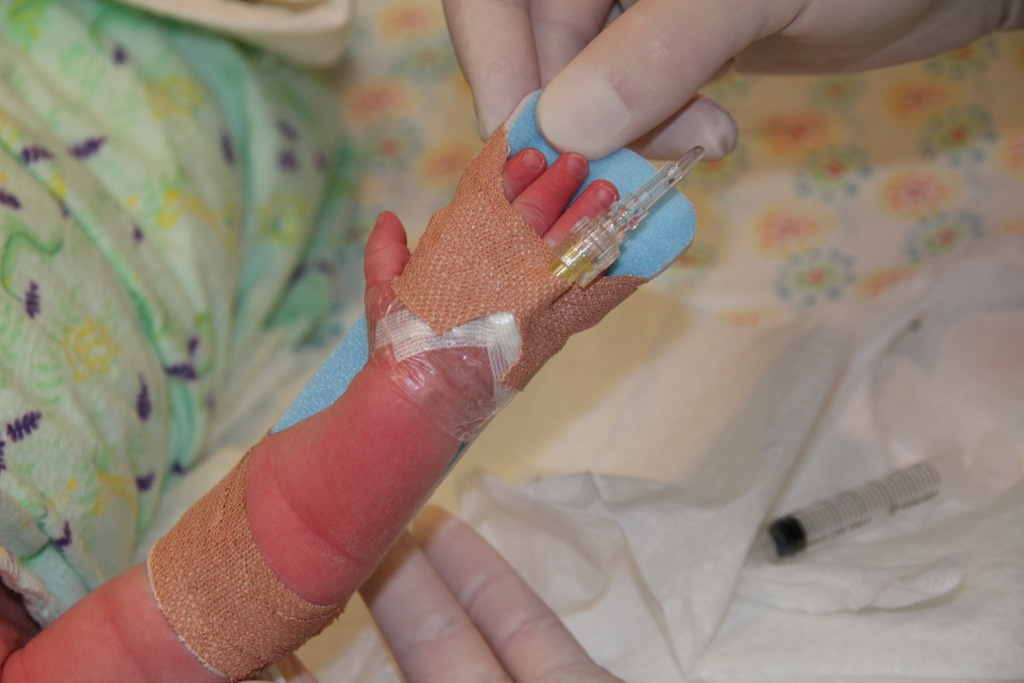 Figure 13: IV insertion complete