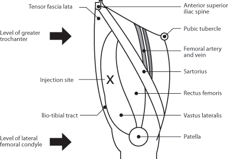 Figure 1: Anatomical markers, immunisation