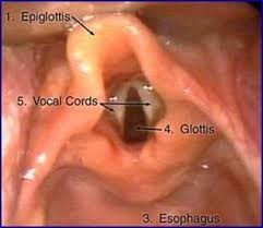 Intubation procedure for neonates