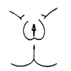Prader 0: Classical / typical female external genitalia