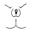 Prader 1: Female external genitalia with clitoromegaly