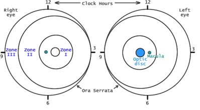 ROP zones