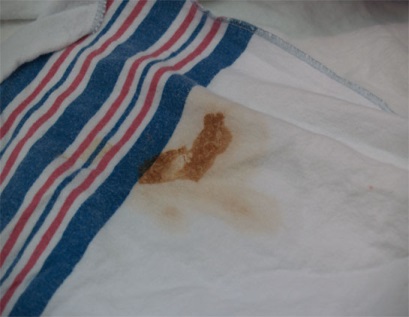 Figure 3: Vomited blood