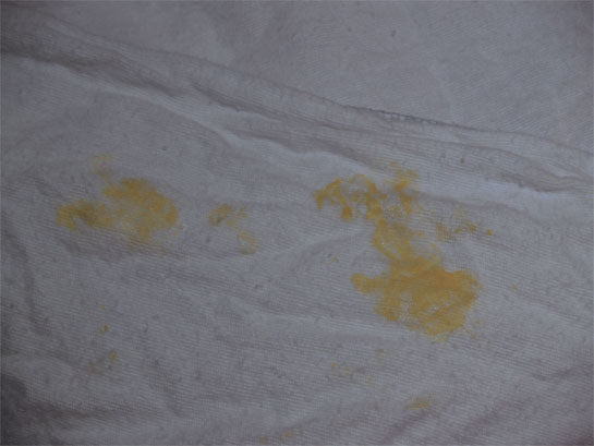 Figure 2: Vomited colostrum
